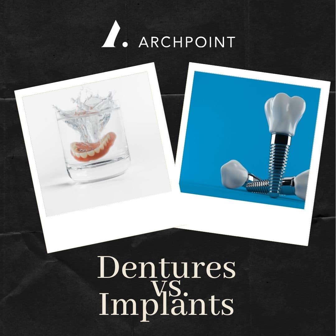 dentures and dental implants