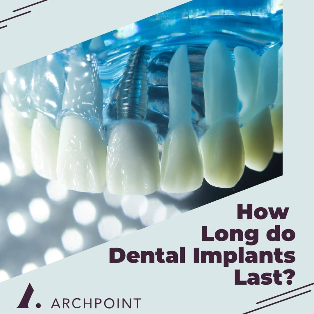 How long dental implants last