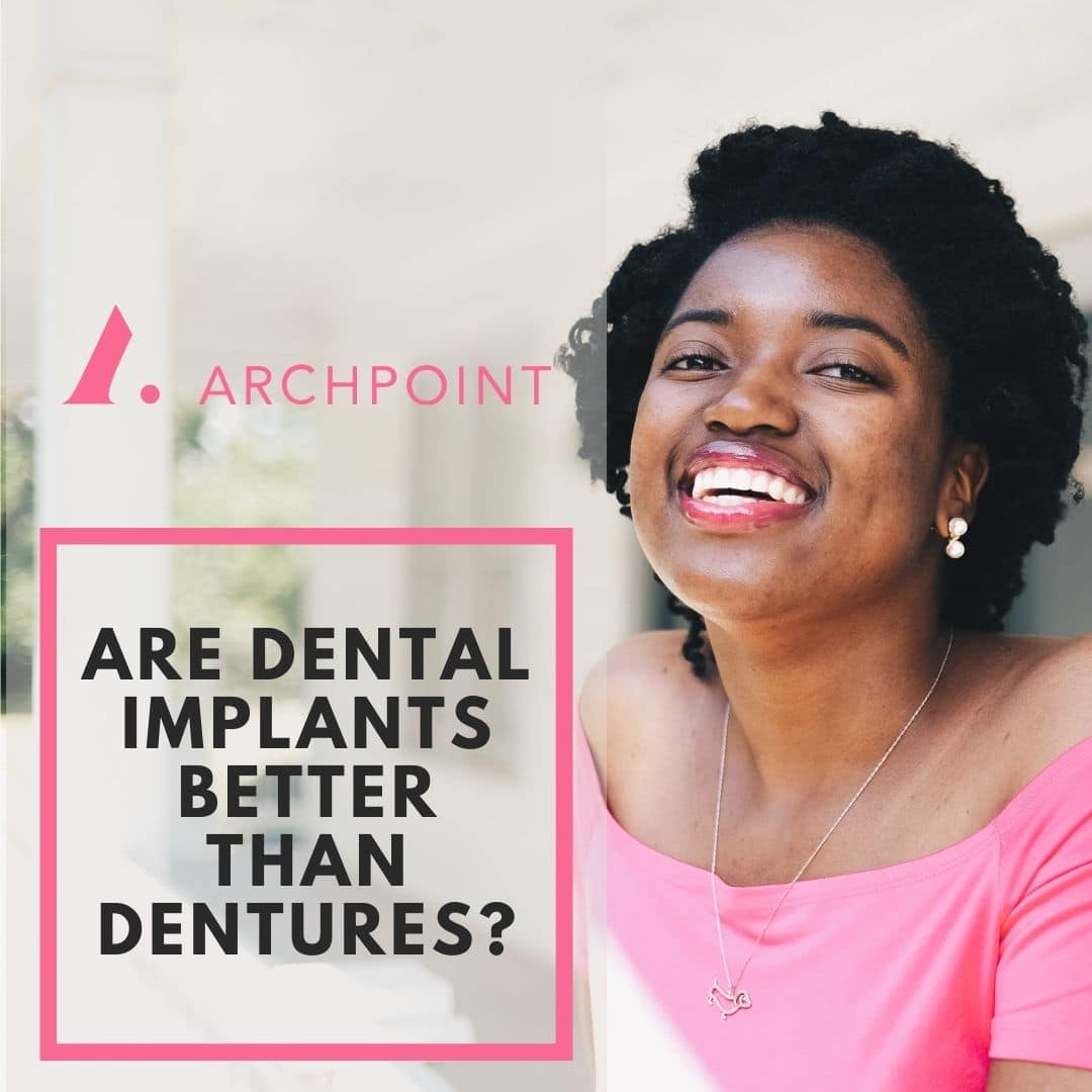 dentures vs. implants