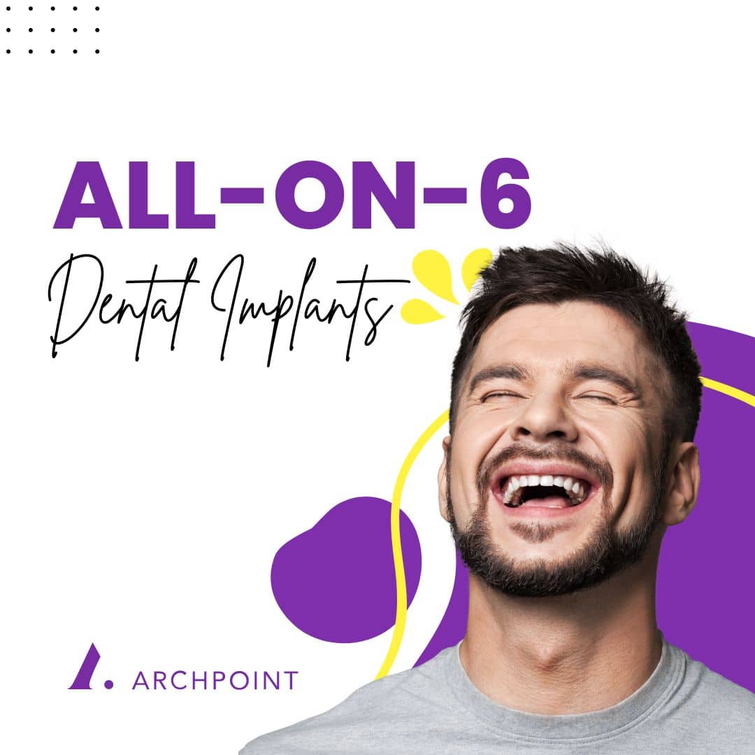 DFW All-on-6 implants