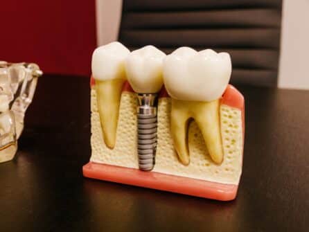 what is a mini dental implant