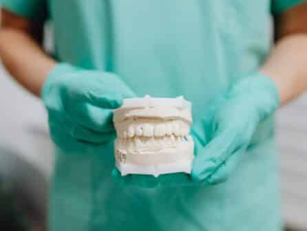 overdentures work with natural teeth